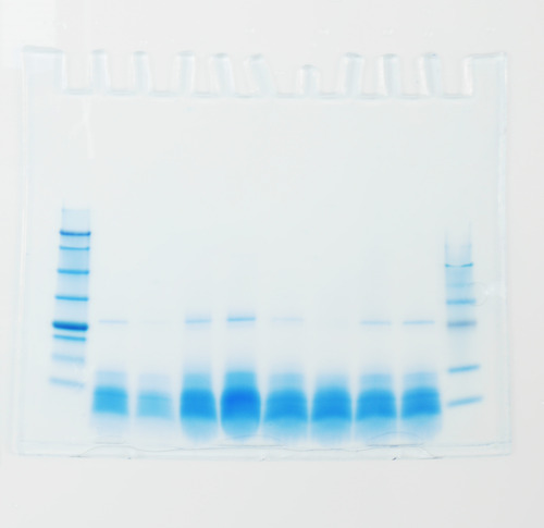 Protein gel on white light plate