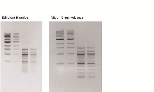 agarose gel stained with Ethidium Bromide