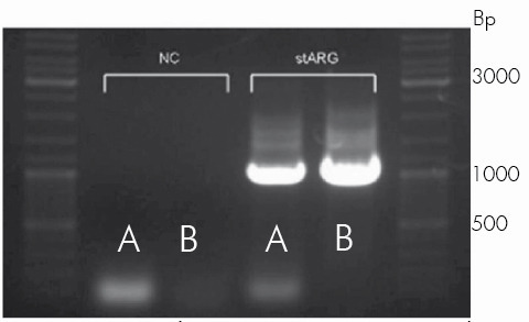 Comparison between Polymerase blends. Robust polymerase